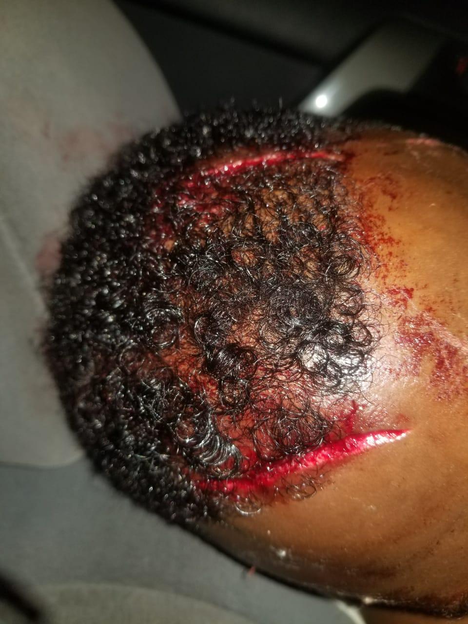 Image result for saumu mbuvi injured